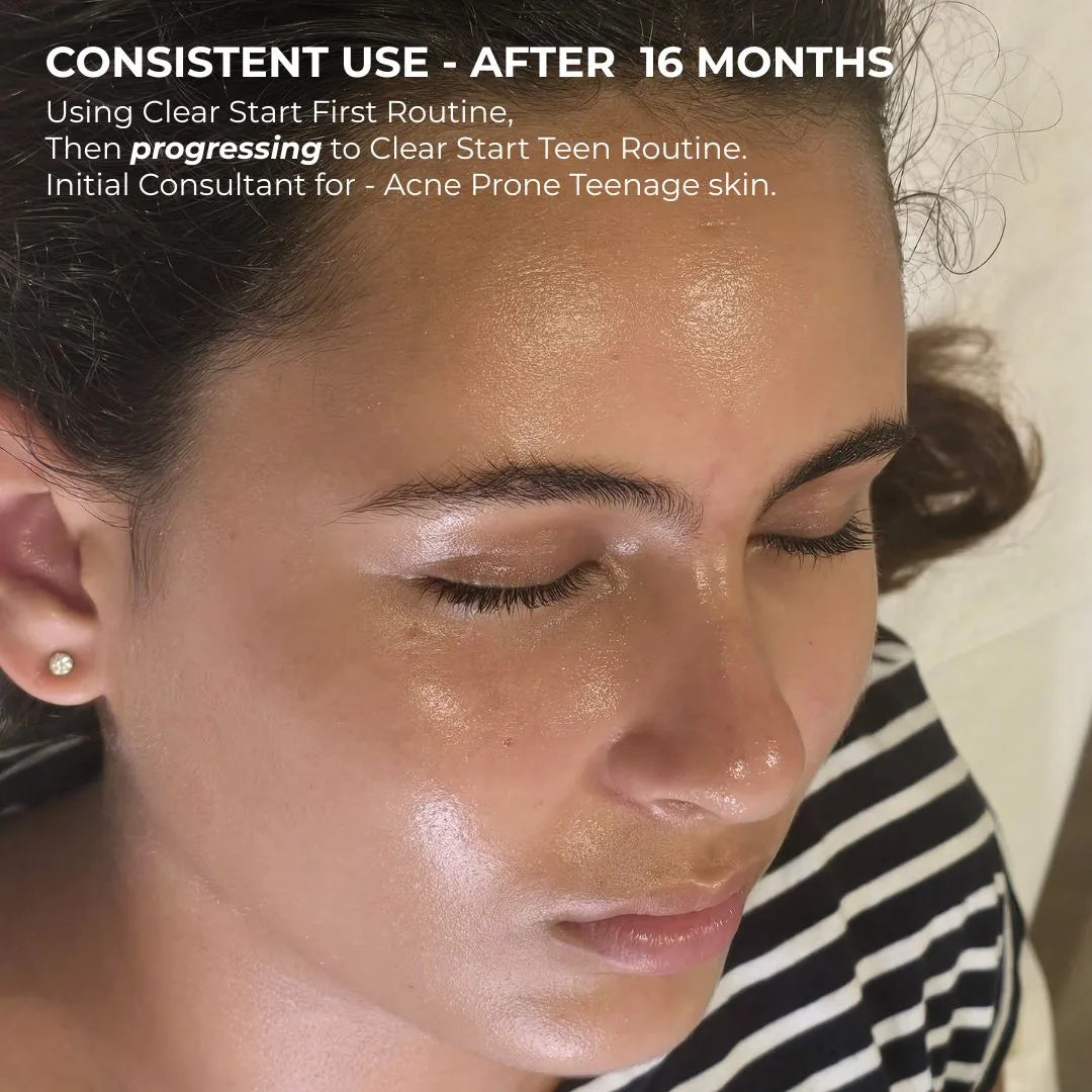 Alpha-H Clear Start First Routine