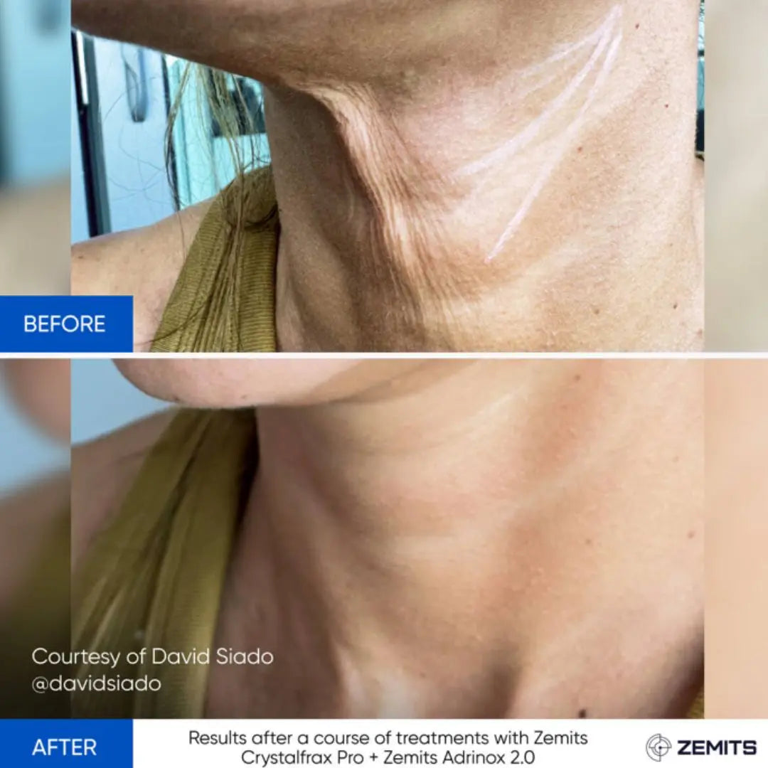 Zemits Zemits Adrinox 2.0