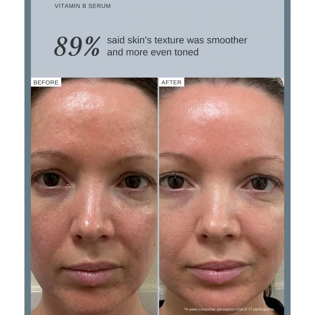 Alpha-H Vitamin B Serum before and after results showing 89% said skin texture was smoother and more even toned