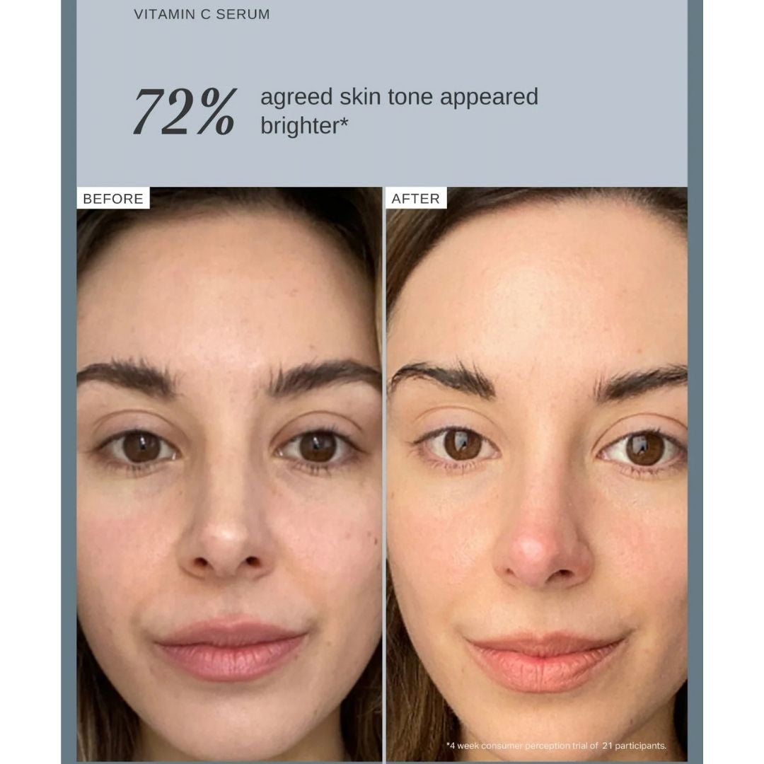 Alpha-H Vitamin C Serum before and after results showing 72% agreed their skin tone appeared brighter after a four-week consumer trial