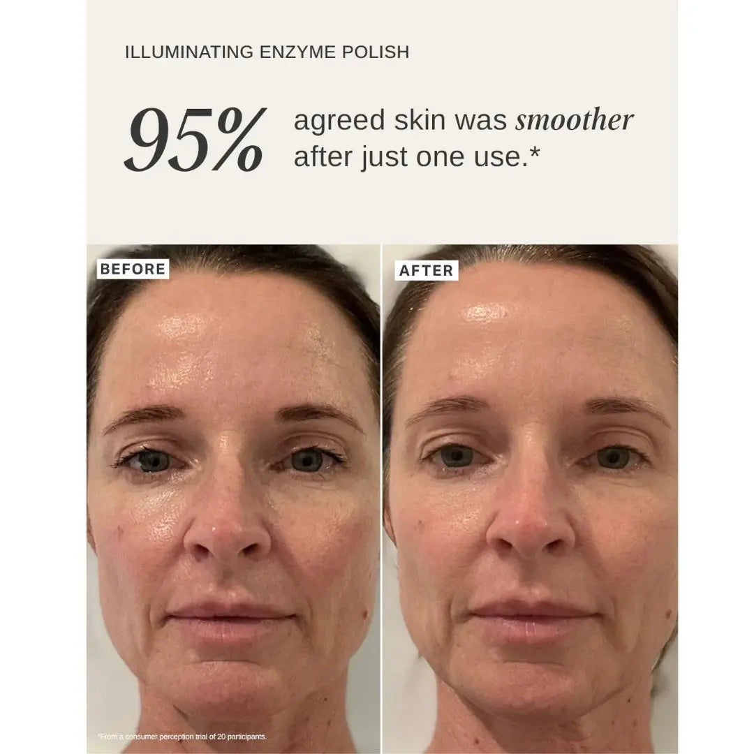 Before and after comparison of a woman's face. Visual result after using Alpha H Illuminating Enzyme Polish
