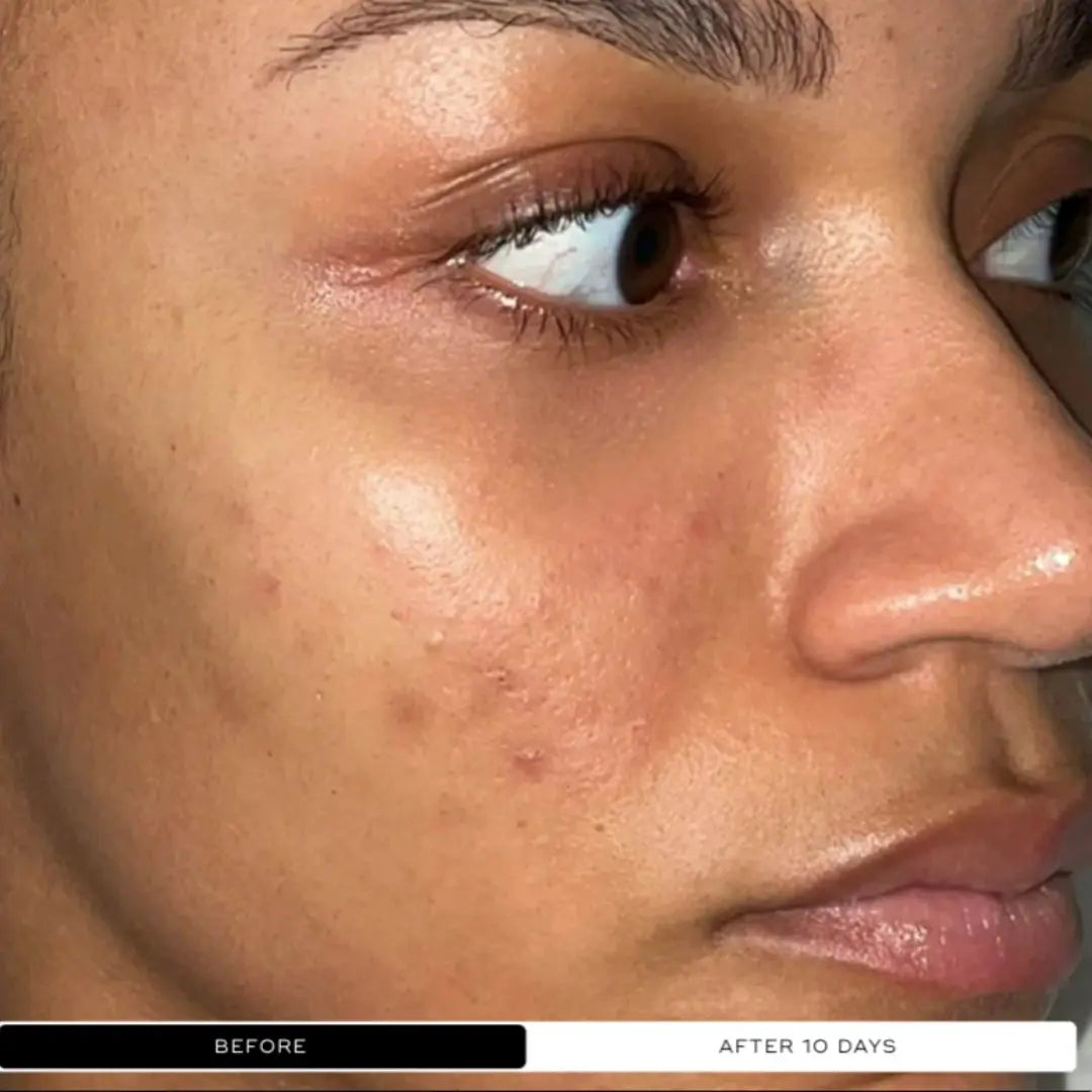 Medik8 Crystal Retinal 20, 30ml