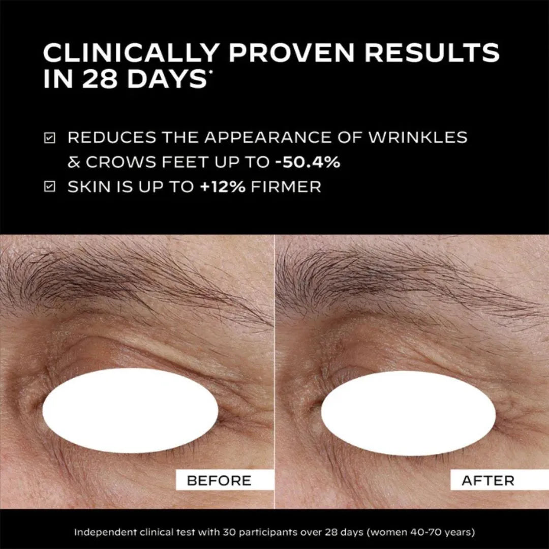 Before and after comparison of eye wrinkles with clinical proven results in 28 days.