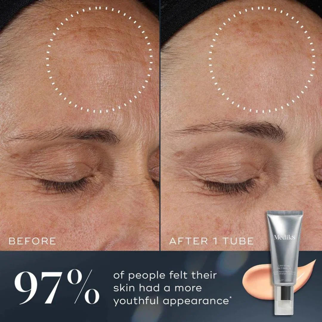Medik8 Crystal Retinal 1 30ml – before and after skin comparison