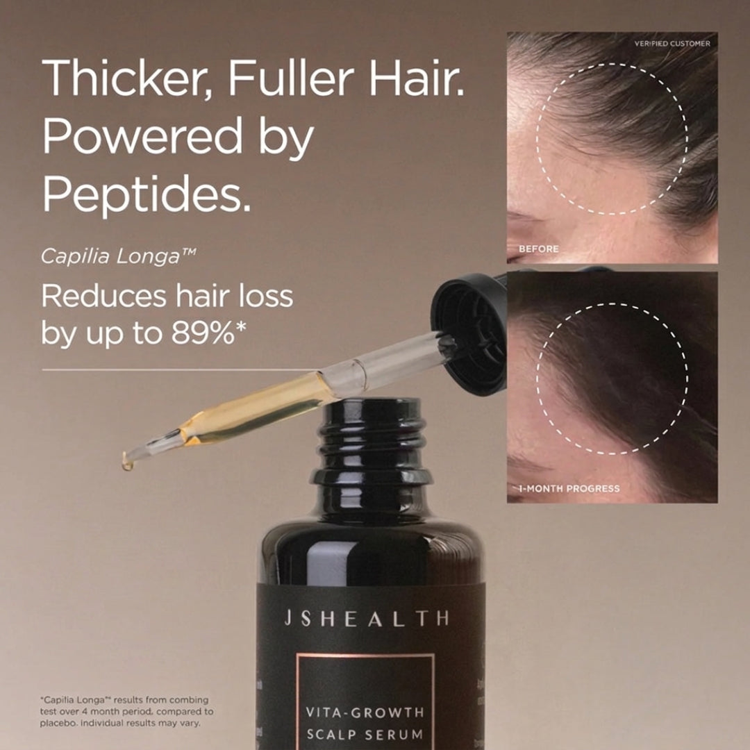 JSHealth Vita-Growth Scalp Serum – product shot with key formula callout on beige background