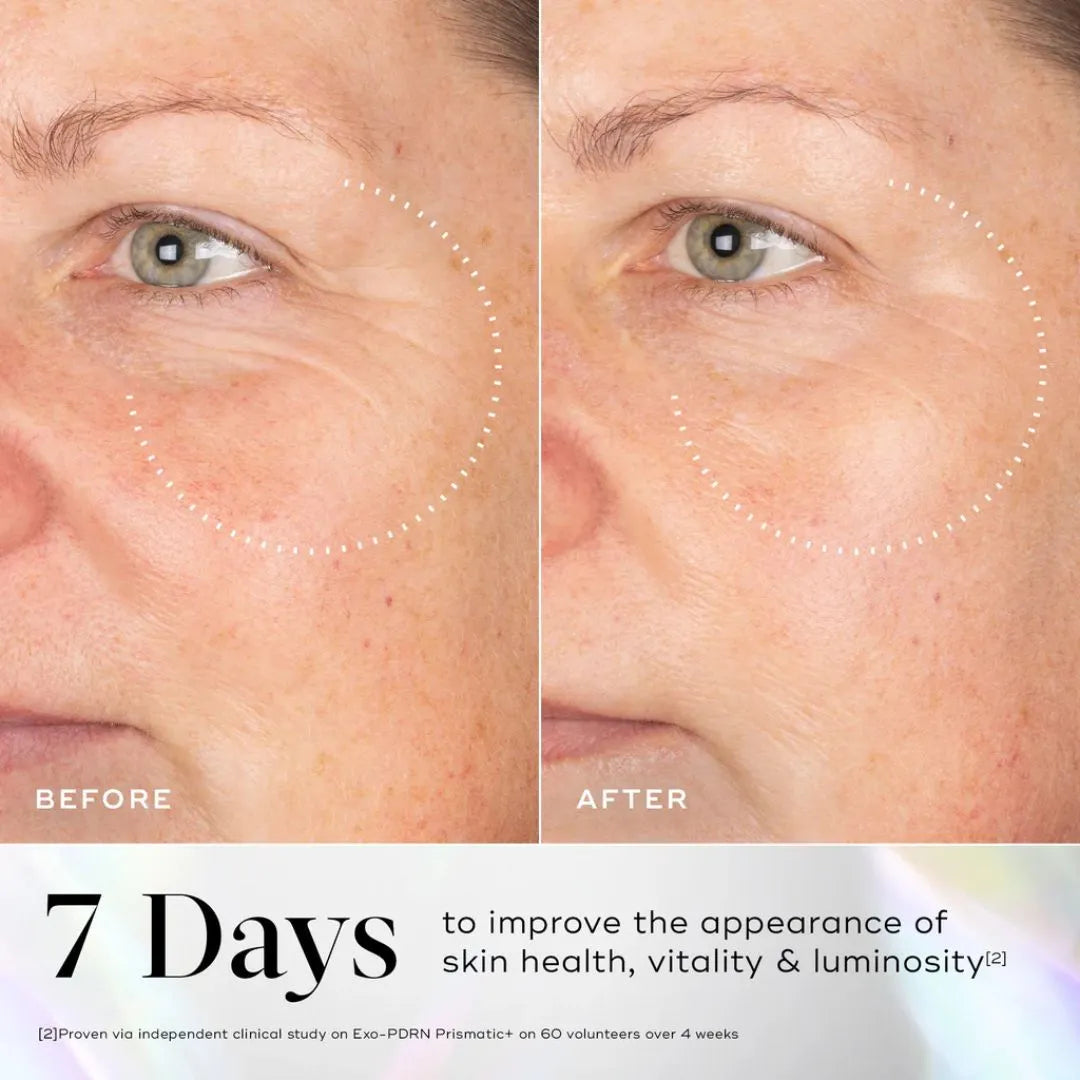 Medik8 Exo-PDRN Prismatic+ Youthful Vitality Serum with Prismatic PDRN & Triple Exosome Complex - 30ml