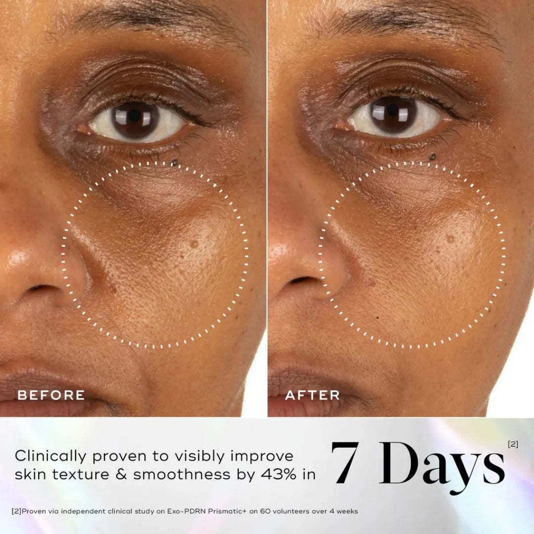Medik8 Exo-PDRN Prismatic+ Youthful Vitality Serum with Prismatic PDRN & Triple Exosome Complex - 30ml