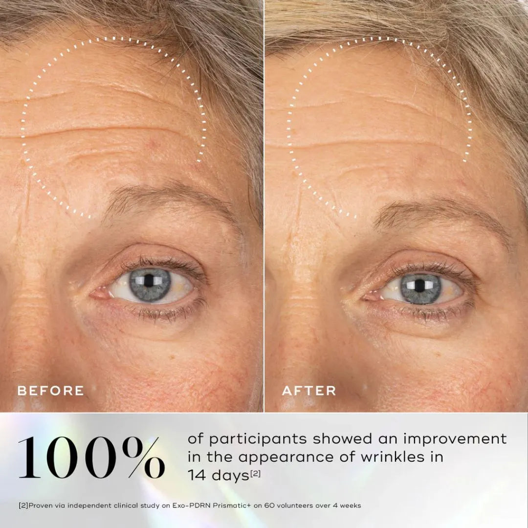 Medik8 Exo-PDRN Prismatic+ Youthful Vitality Serum with Prismatic PDRN & Triple Exosome Complex - 30ml