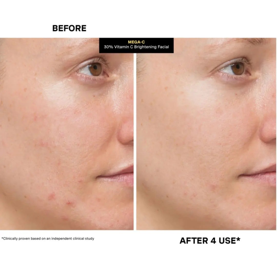 Kate Somerville Mega C 30 Vitamin C Brightening Facial Mask, 60ml