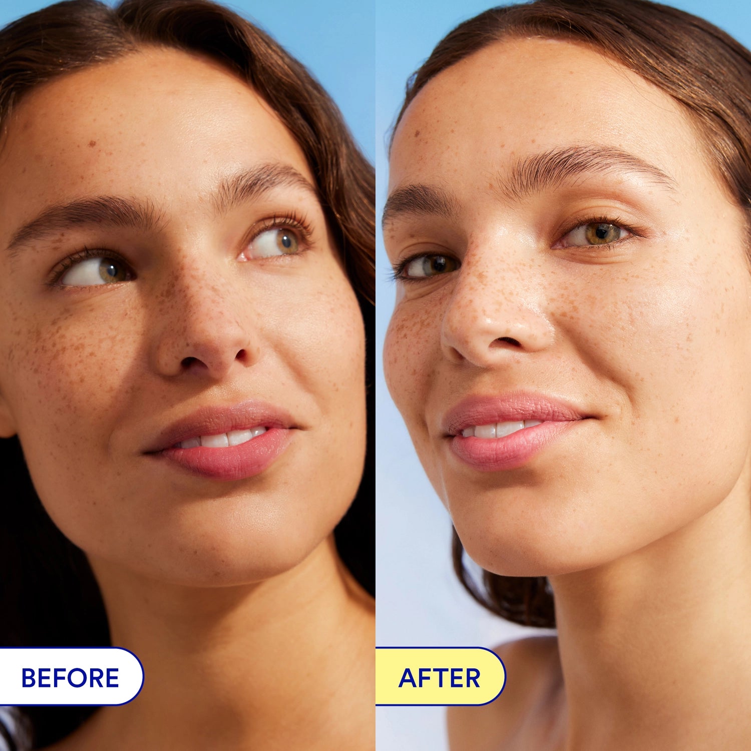 Before and after comparison of a woman's face with visible skin improvement.