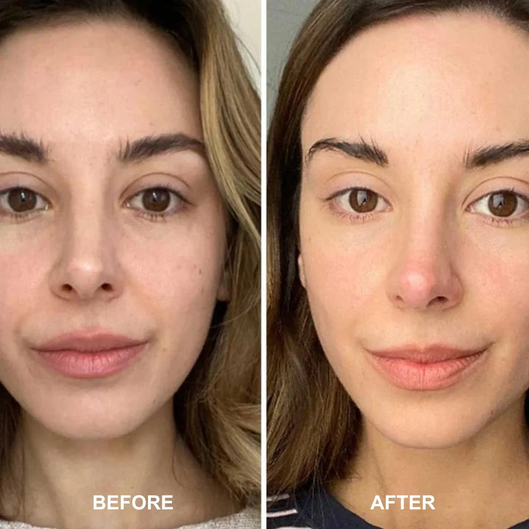 Alpha-H Vitamin C Brightening Serum 10% 15ml – before and after: dull, uneven skin brightened to more radiant, even-toned complexion