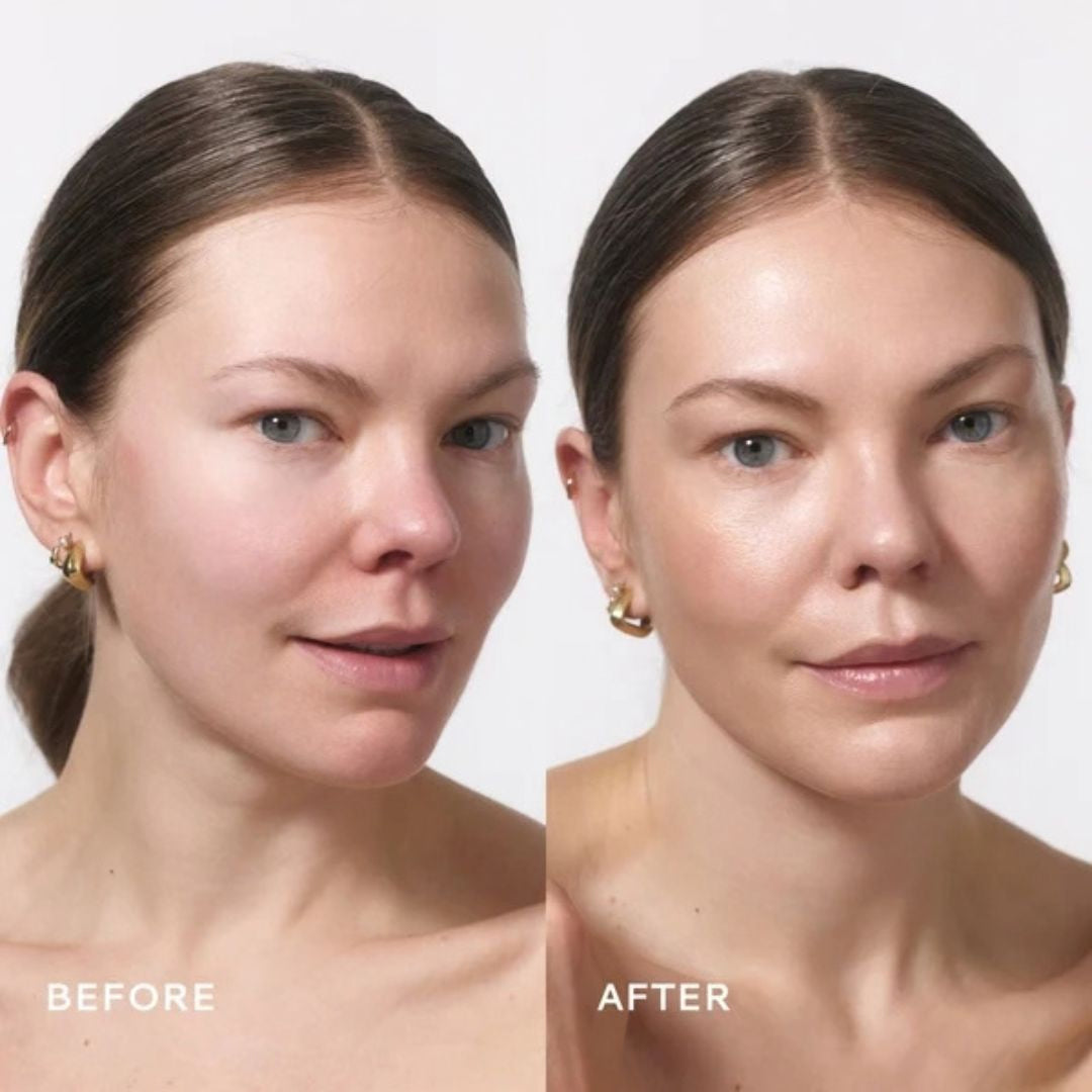 Before and after comparison of a woman's face showing skincare results, with 'BEFORE' on the left and 'AFTER' on the right, against a light gray background.
