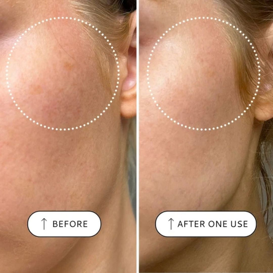 Votary Sensitive Resurfacing Peel before and after one use showing the appearance of smoother, more even-looking skin
