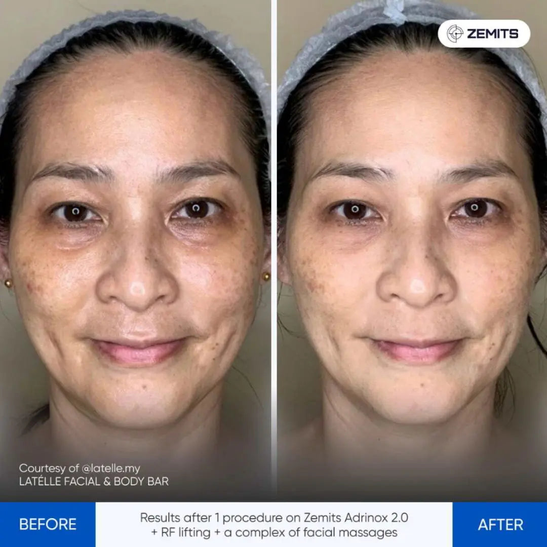 Zemits Zemits Adrinox 2.0