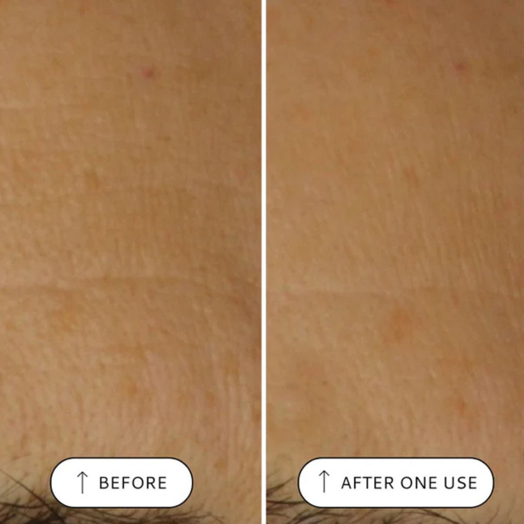 مصل Votary Super Seed - بذور البروكلي والببتيدات