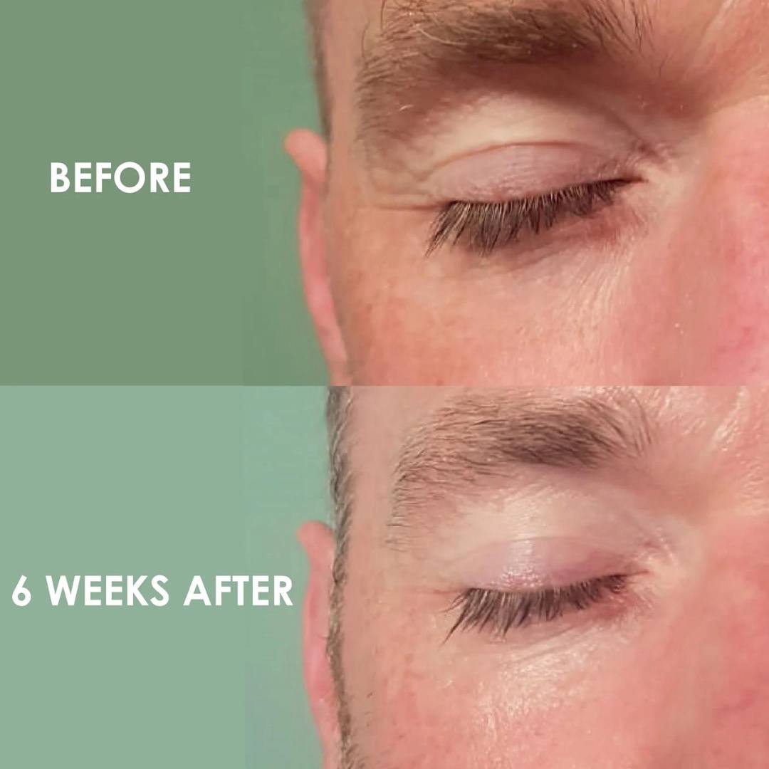 Humanity Eye Restore Results