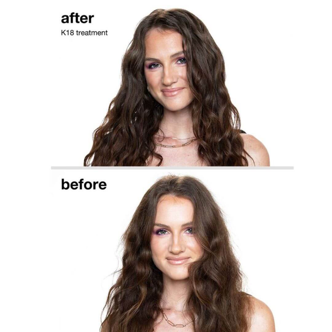 K18 Treatment Before and After
