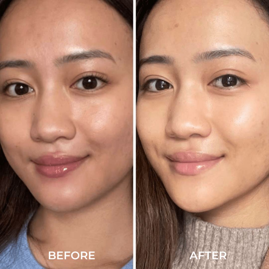 Alpha H Liquid Gold Before and After