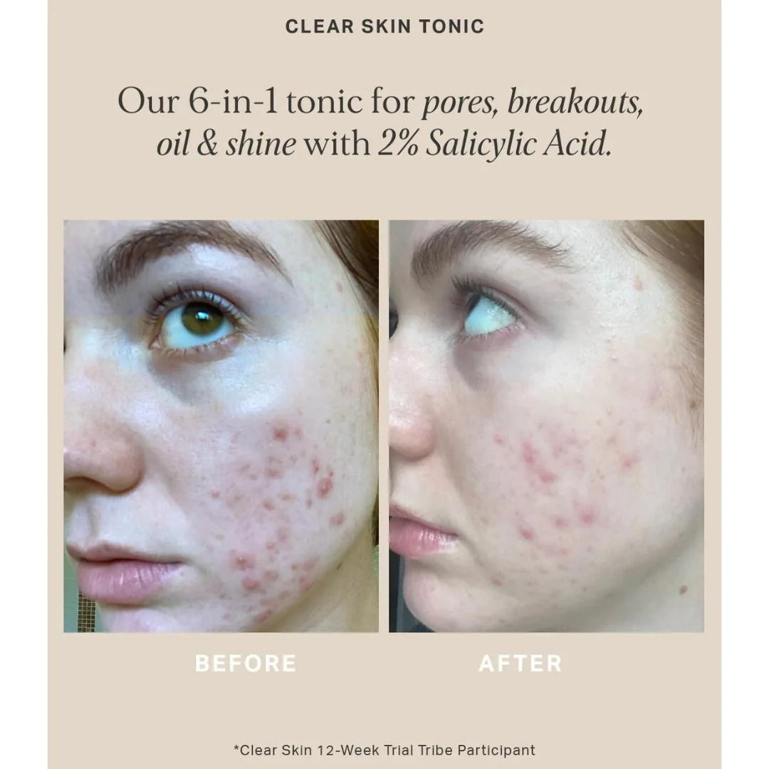 Alpha-H Clear Skin Tonic 2% BHA Salicylic with Seboclear 100ml – verified customer reviews panel on light background