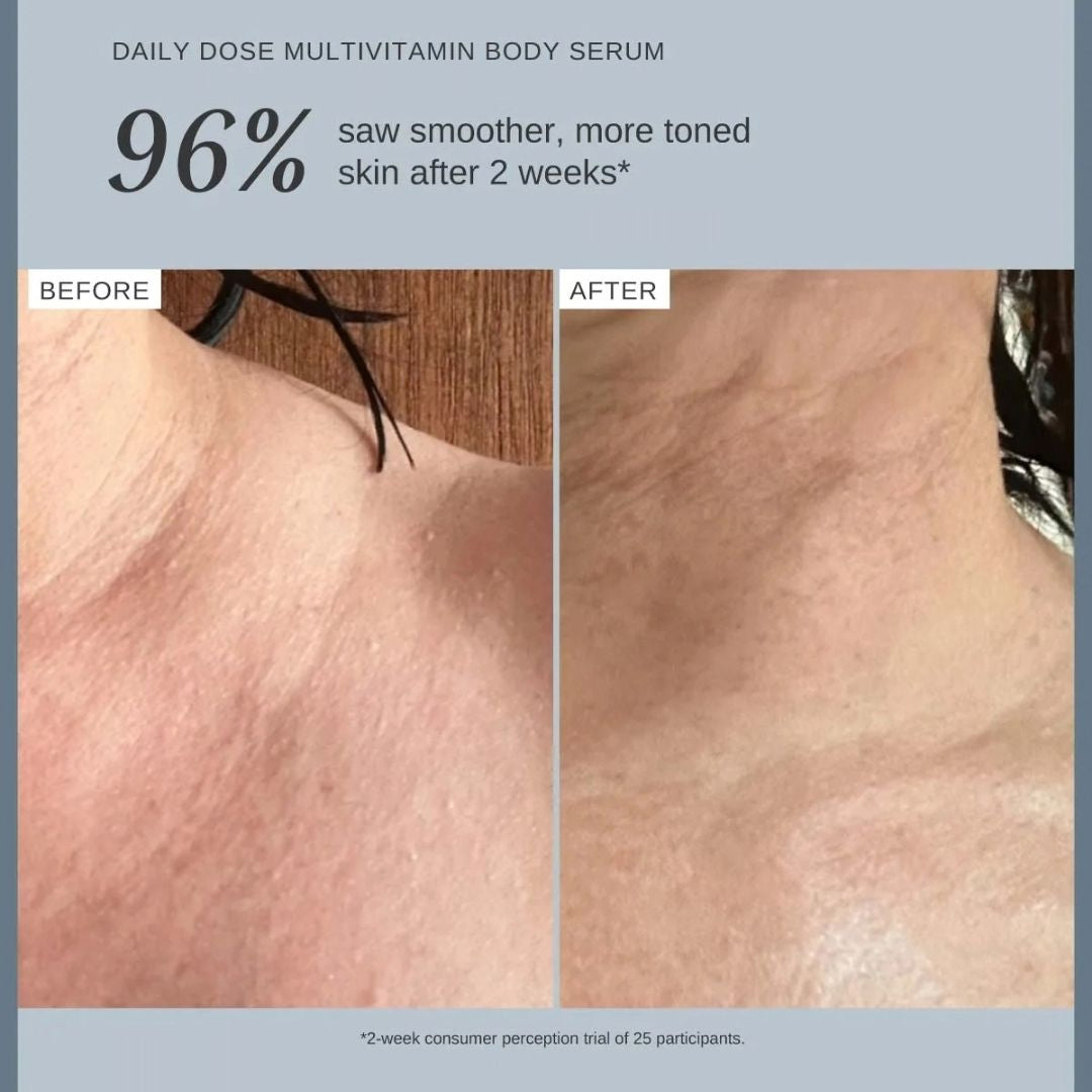 Alpha-H Daily Dose Multivitamin Body Serum before and after results showing 96% saw smoother more toned skin after a two-week consumer trial