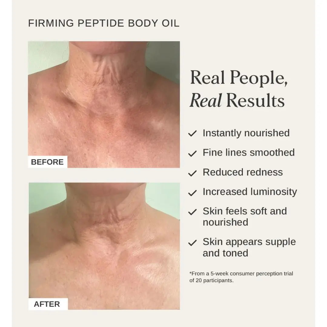  Before and After Use of Alpha H Firming Peptide Body Oil