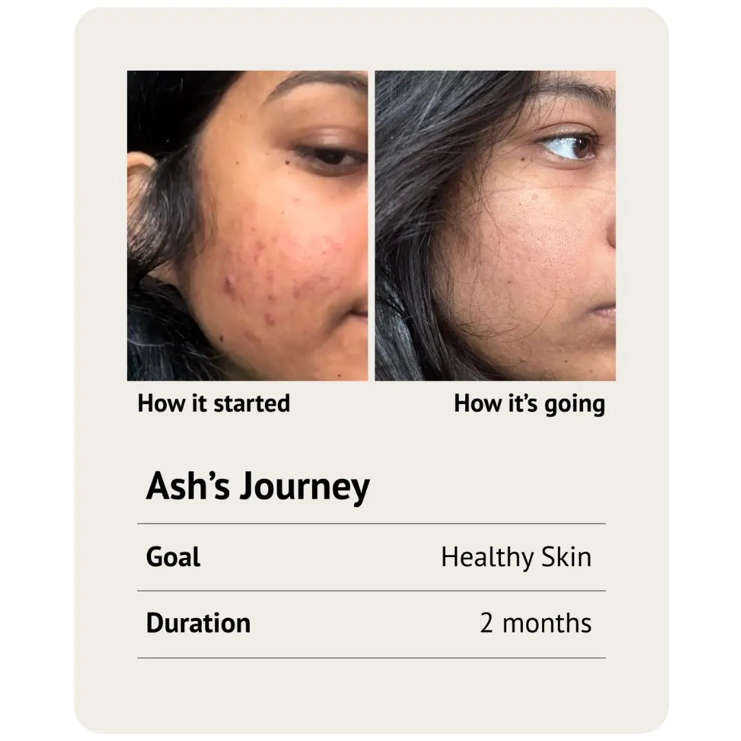 Manifesto Beauty Vitamin Gummies - Refill 30 days