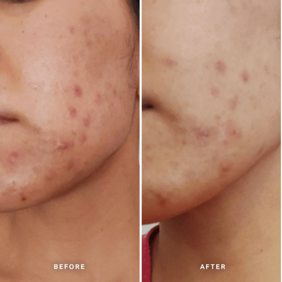 Alpha-H Clear Skin Tonic 2% BHA Salicylic with Seboclear 100ml – product and box packaging shot on white background