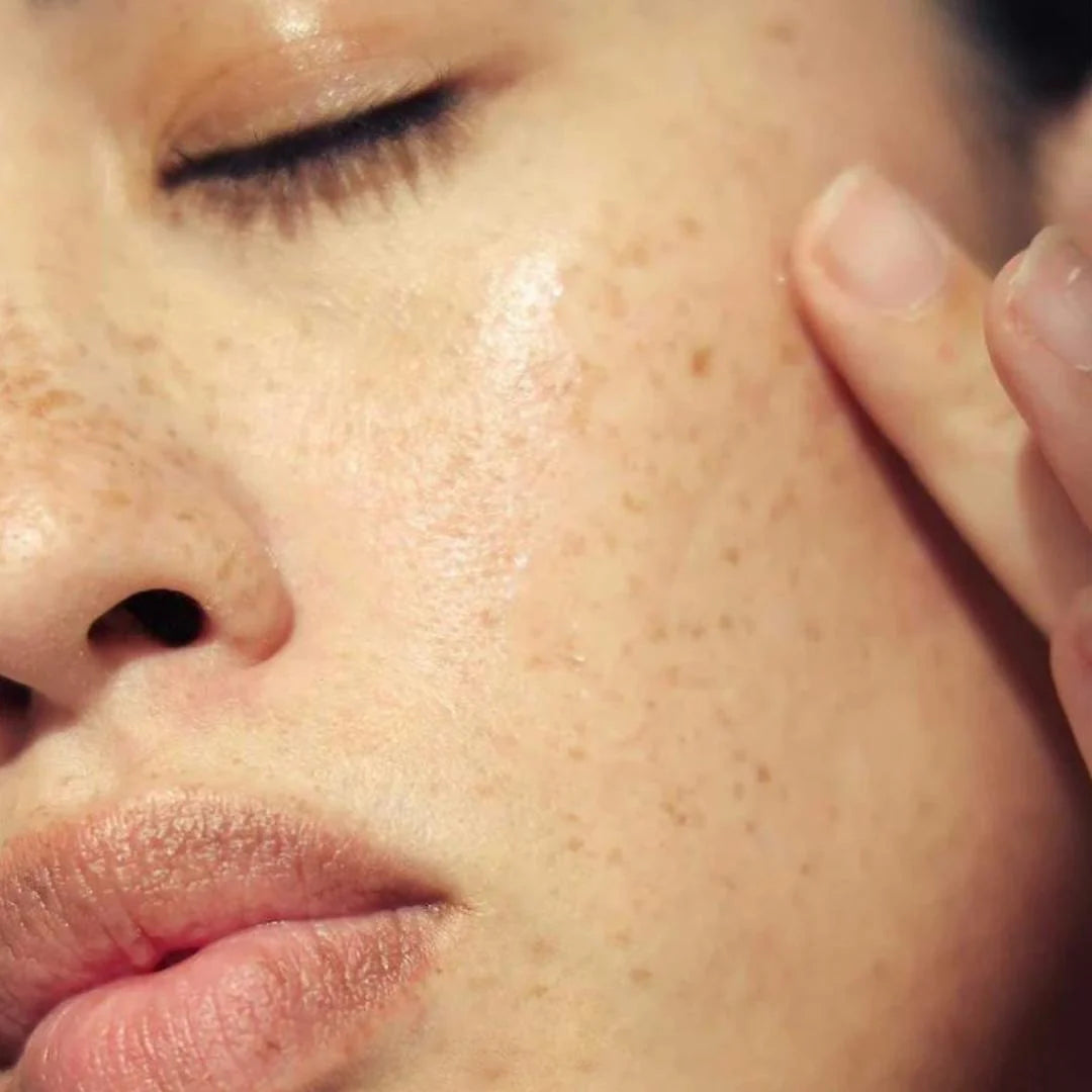 Alpha-H Hyaluronic 8 Super Serum 25ml – before and after: dehydrated skin plumped and hydrated with visible improvement