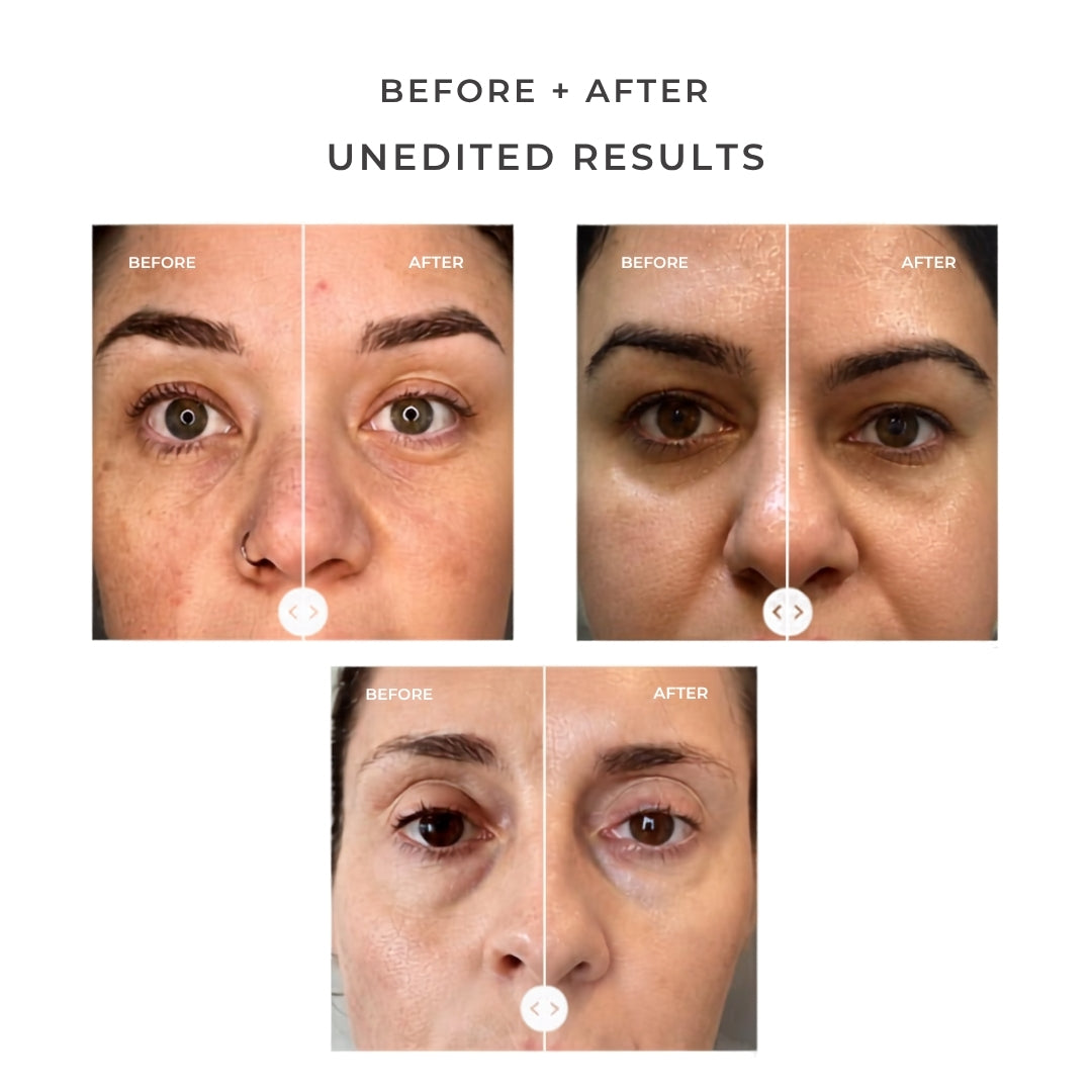 JSHealth Illuminating Peptide Eye Serum 15ml – lifestyle editorial: model applying serum to under-eye area