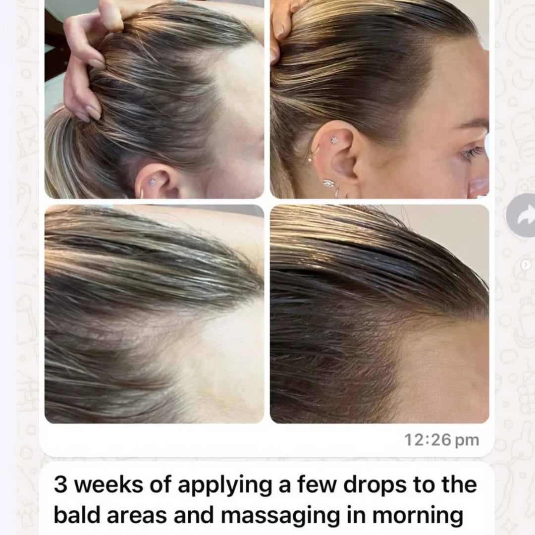 JSHealth Vita-Growth Scalp Serum – dropper tip close-up and serum texture detail