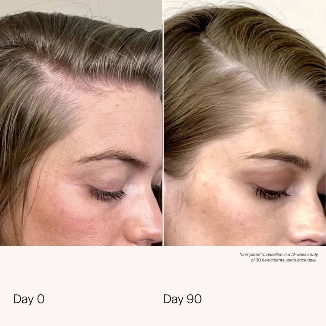 Before and after comparison of a woman's face with text indicating a 90-day study.