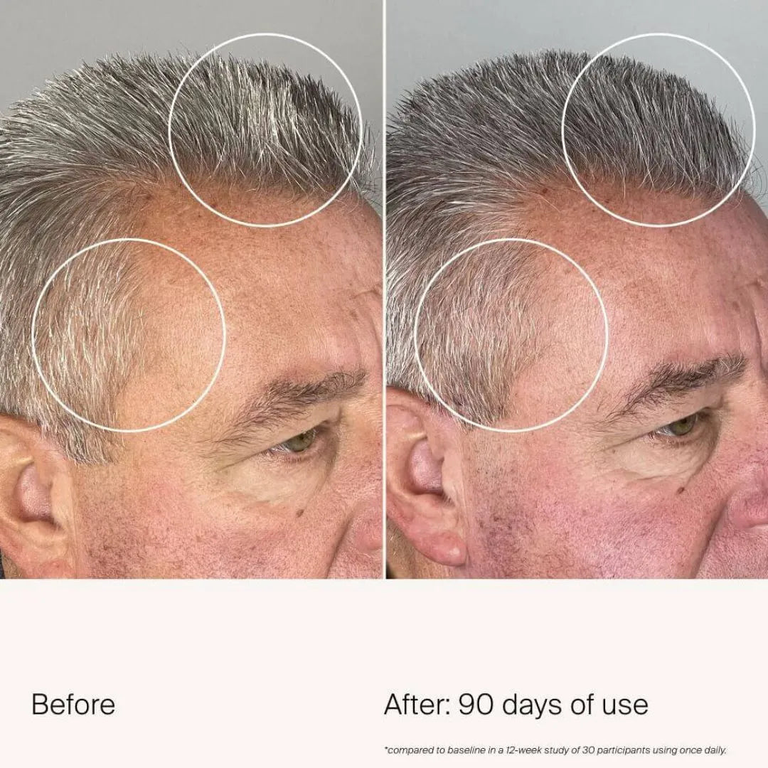 Before and after comparison of a man's hair and skin with text indicating 90 days of use.