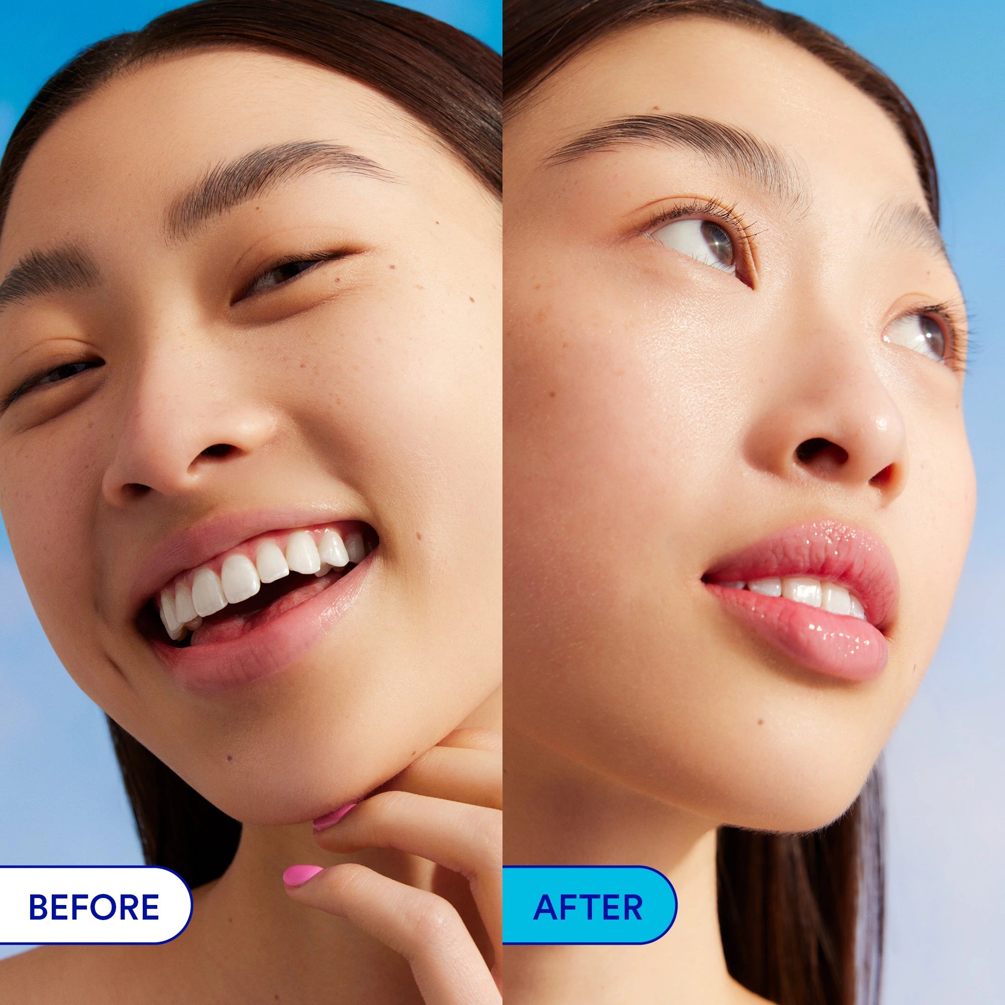 Before and after comparison showing skin improvement with Ultra Violette Vibrant Screen SPF50