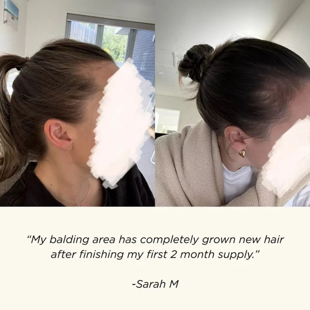 JSHealth Vita-Growth Scalp Serum