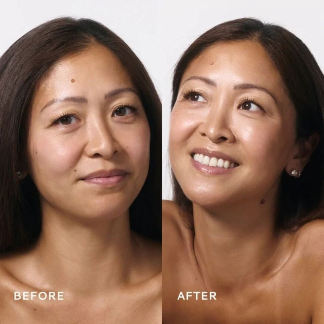 Before and after skincare comparison of a woman's face, showing natural skin texture on the left and smoother, brighter skin on the right, with 'BEFORE' and 'AFTER' text labels.