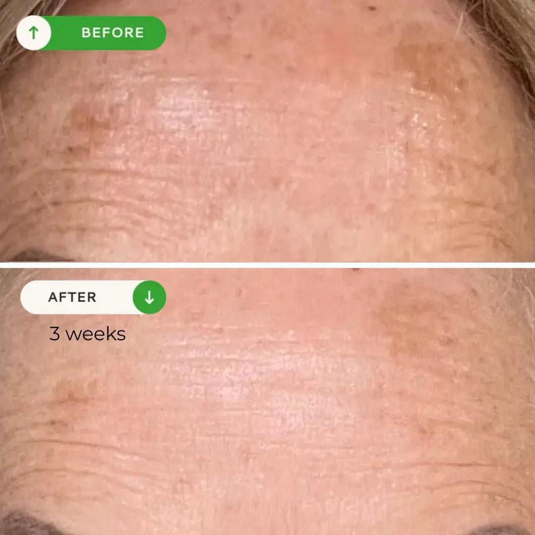 Votary Vitamin C Glow Serum - Niacinamide and Alpha Arbutin, 30ml