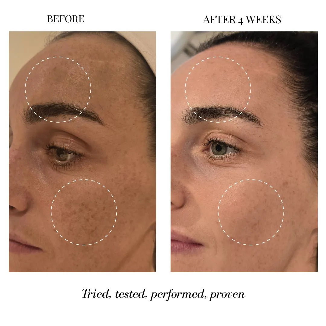 The Pigmentation Edit