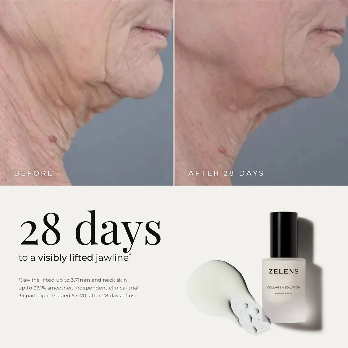 Zelens Collagen Solution before and after 28 days: visibly lifted jawline, up to 3.71mm, and neck skin up to 37.1% smoother in an independent clinical trial