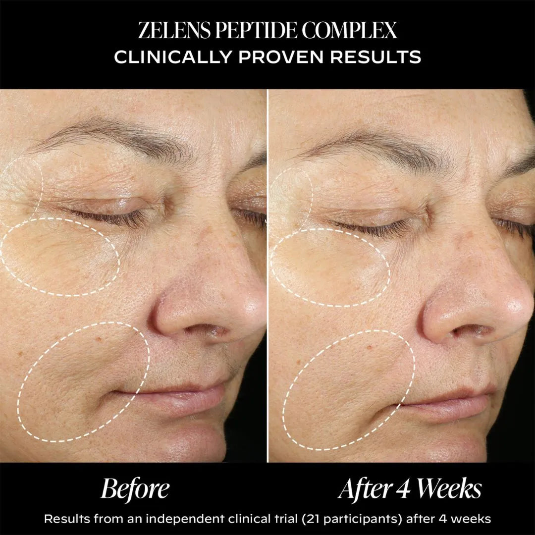 Zelens Peptide Complex -Restructuring Cream, 50ml