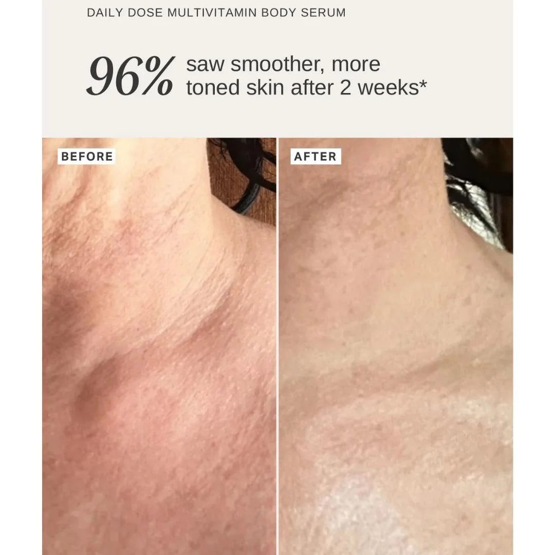 Alpha-H Daily Dose Multivitamin Body Serum 150ml – before and after: dull, dry body skin transformed to smoother, more radiant finish