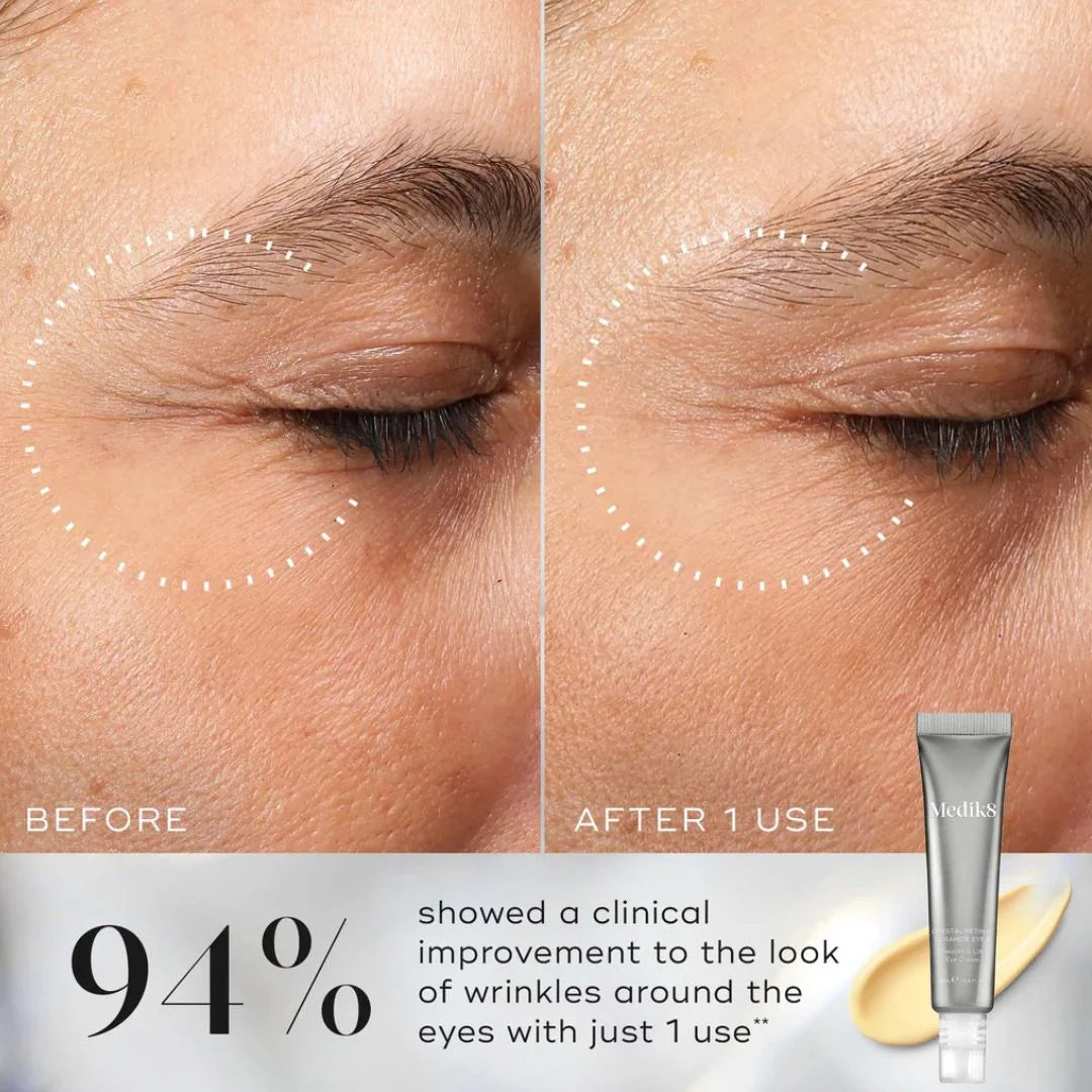 Medik8 Crystal Retinal Ceramide Eye 10 15ml – before and after eye area comparison: 94% showed improvement to wrinkles with just 1 use