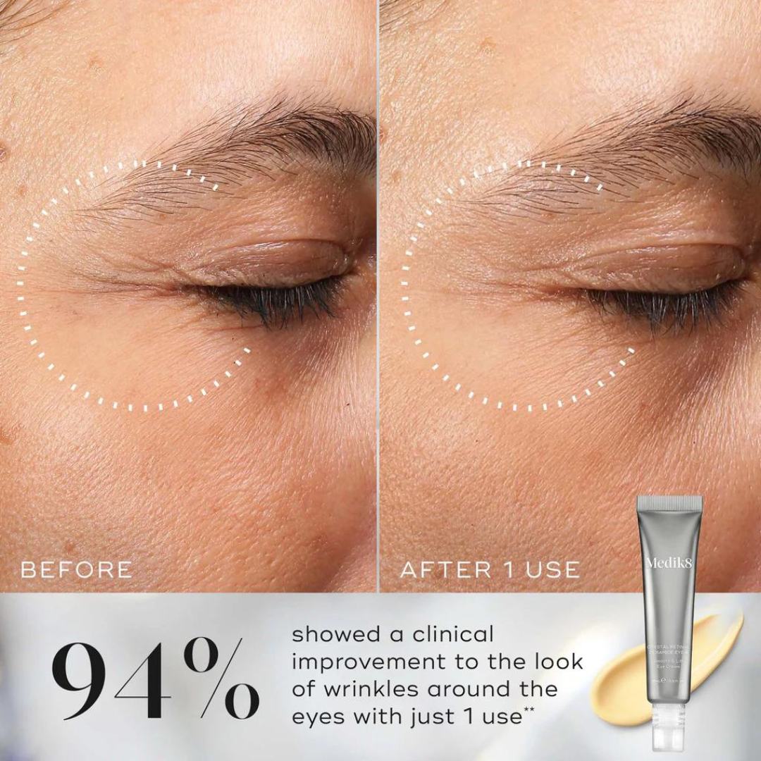 Medik8 Crystal Retinal Ceramide Eye 6 15ml – before and after eye area comparison: 94% showed improvement to wrinkles with just 1 use
