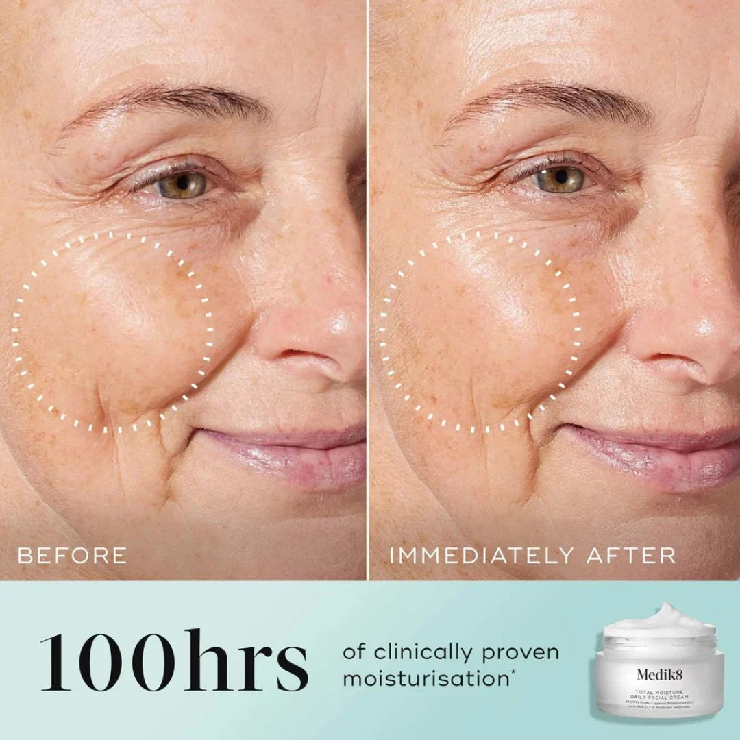 Medik8 Total Moisture Daily Facial Cream 50ml – before and after skin comparison: 100hrs of clinically proven moisturisation, immediately after application