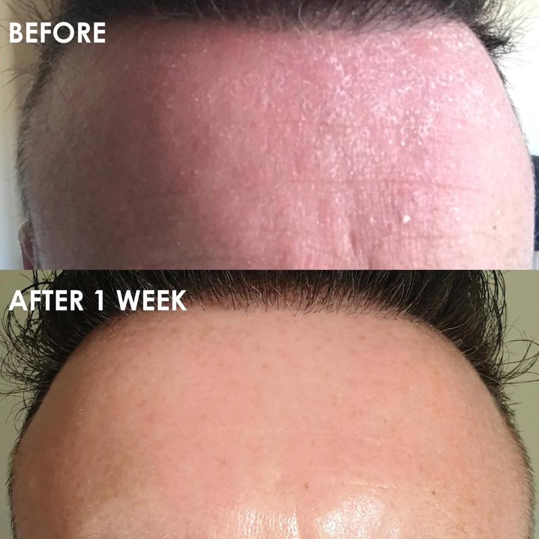  Male Face Polish Before and After