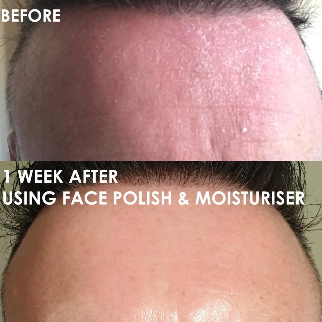Male Moisturiser Before and After