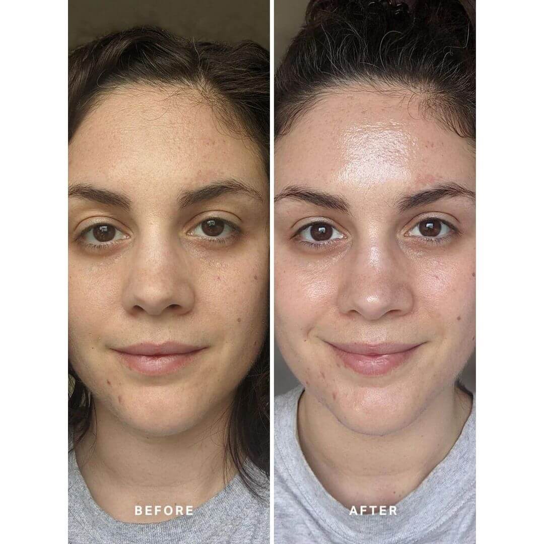 Pigmentation Duo Before and After