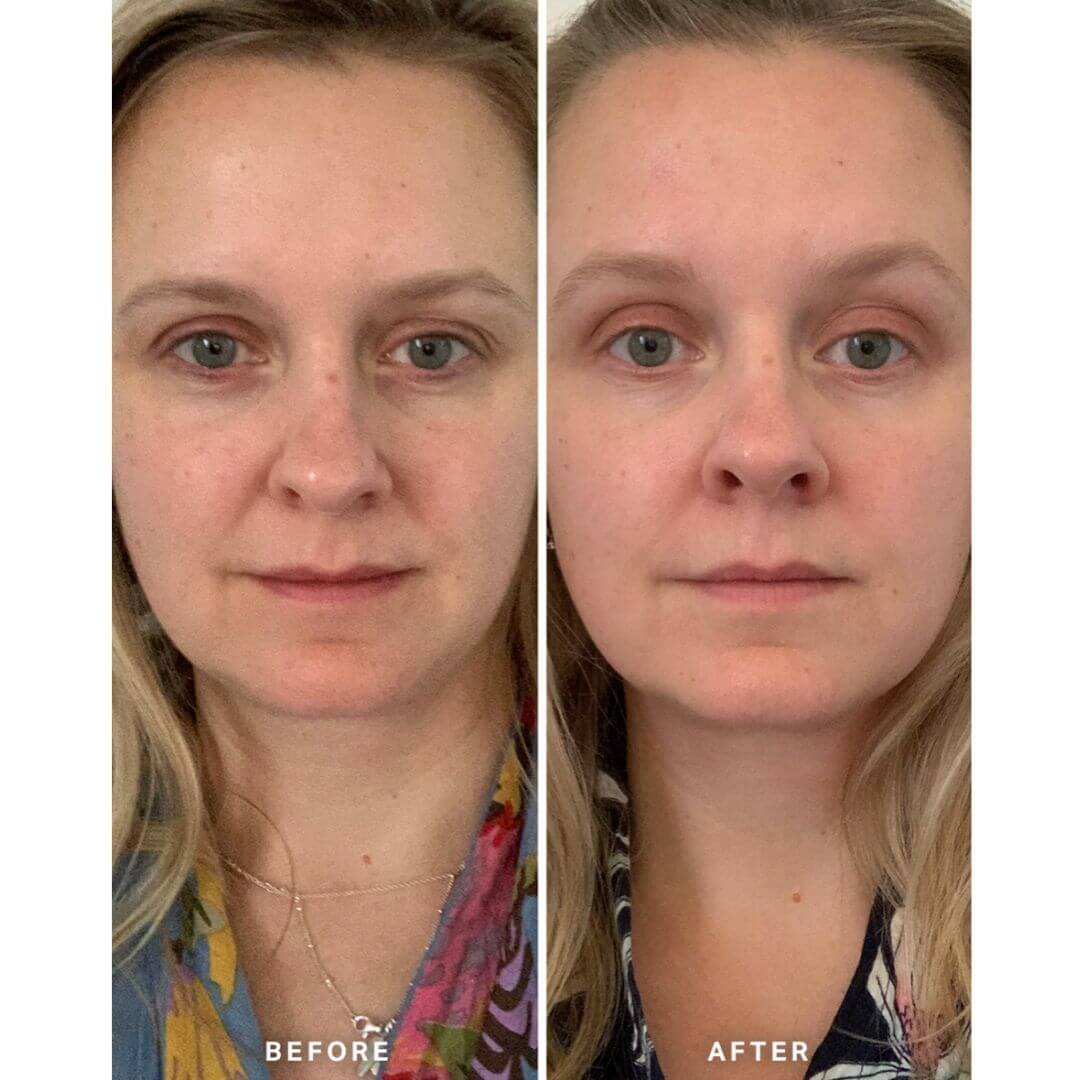 Alpha H Vitamin A Serum Before and After