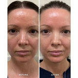 Alpha H Vitamin B Serum Before and After